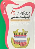 کتاب دست دوم  پروتزهای ایمپلنت دندانی  میش 2015 (خلاصه نکات) تالیف احسان محمدیان امیری- در حد نو 